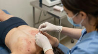 Cyclosporiasis Symptoms