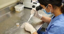 New Yorkers most affected by national diarrhea parasite outbreak: CDC